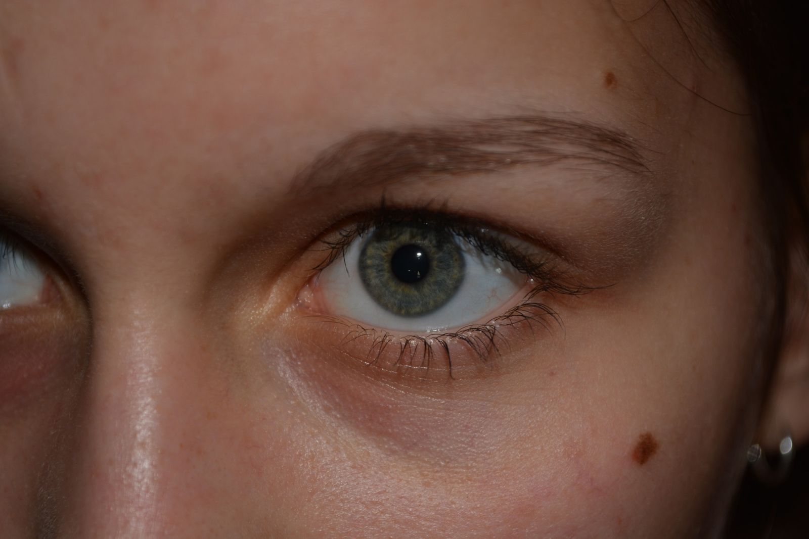 facial analysis moles read